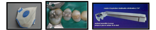 depose d'amalgame dentiste tournefeuille
