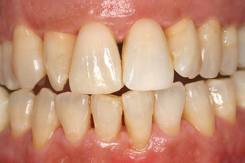 dentiste tournefeuille